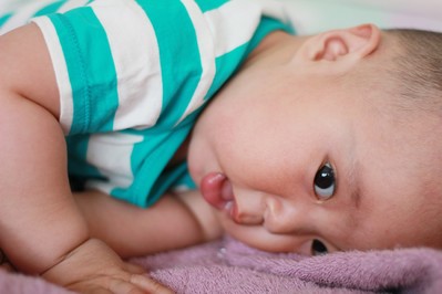Dysplazja stawu biodrowego u niemowląt