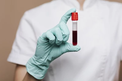 Morfologia krwi – co wskazuje i jak interpretować wyniki?