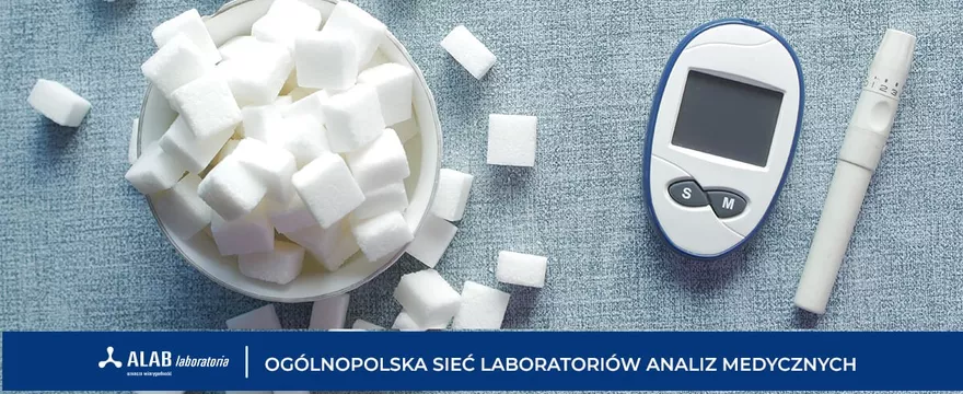 Na czym polega badanie glukozy i dlaczego jest ważne w profilaktyce zdrowia?